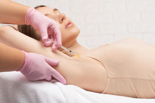 The doctor makes injections of botulinum toxin in the underarm area against hyperhidrosis. Women's cosmetology concept.