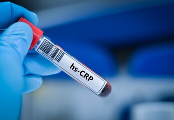 Fototapeta premium Blood sample tube for hs-CRP test analysis.