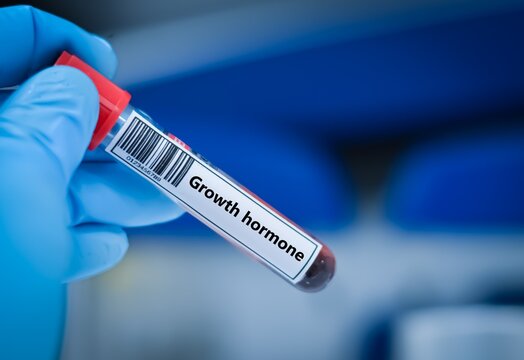 Blood sample tube for growth hormone test analysis.