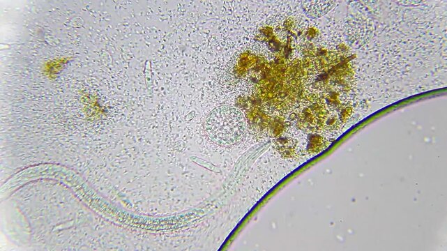Large bacterial colony with a ciliate cyst and a nematode nearby under 400x brightfield microscopy. Detailed 4K scientific stock footage of mixed microbial community.