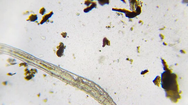 Large annelid worm surrounded by a bacterial colony under 40x brightfield microscopy. Detailed 4K scientific stock footage of worm and microbial interaction.