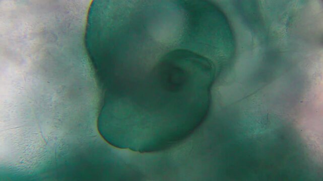 Stentor ciliate showing contractile vacuole, cilia, and oral opening under 400x brightfield microscopy. Detailed 4K scientific stock footage of protozoan morphology.