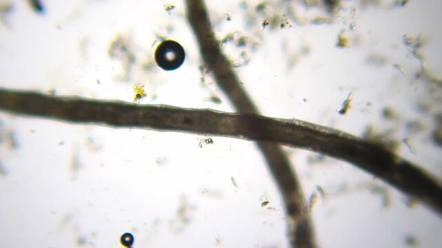 Two large annelid worms surrounded by rotifers under 40x brightfield microscopy. Detailed 4K scientific stock footage of mixed freshwater microfauna.