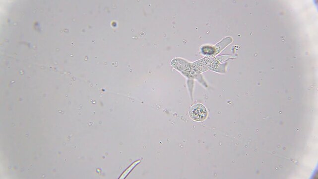 Amoeba moving with pseudopodia near a unicellular protozoan under 400x brightfield microscopy. Detailed 4K scientific stock footage of amoeboid locomotion and microbial interaction.