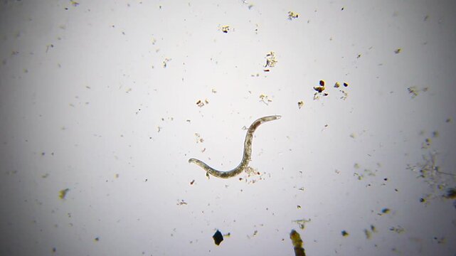 Moving nematode containing visible internal eggs under 40x brightfield microscopy. Detailed 4K scientific stock footage of parasitic worm behavior and internal structures.