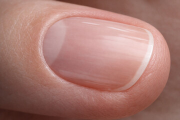 Fototapeta premium Close-up of healthy fingernail on human finger