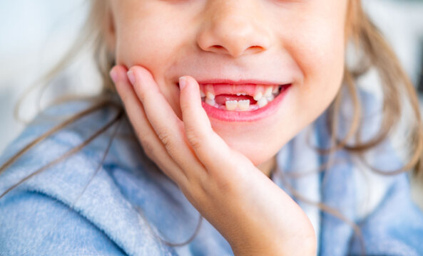 happy positive funny toothless 6-year-old girl, Close-up smiling child's face, showcasing missing baby teeth and joyful expression, waiting for toothfairy, innocence, growth, and childhood milestones