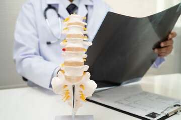 Doctor examining spine bone radiography xray film.