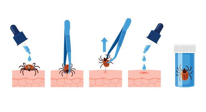 Illustration of tick removal steps: 1. Apply liquid on tick using dropper. 2. Use tweezers to grasp tick. 3. Lift tick upward. 4. Apply liquid to wound. 5. Place tick in container.