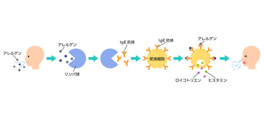 アレルギー発症のしくみ　花粉症のメカニズム