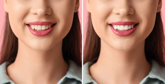Smiling young woman on pink background, closeup