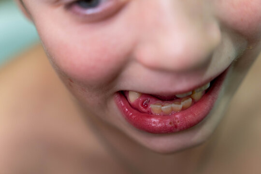 Close-up of a young child's face showing missing teeth and a playful expression, with soft focus on the background highlighting the child's features