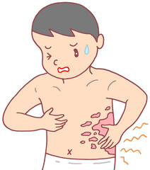 病気・疾患のイラスト - 帯状疱疹・皮膚疾患・皮膚炎