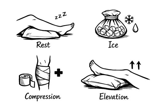 Rice treatment method: rest ice compression elevation for injury recovery