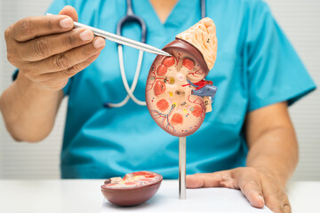 Obraz premium Chronic kidney disease, doctor with model for treatment urinary system, urology, Estimated glomerular filtration rate eGFR.