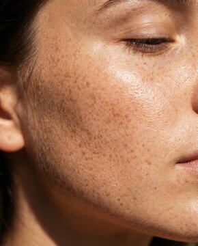 Sunlit close up freckled face skin texture with closed eye natural beauty
