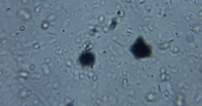 live microscopic observation of a natural micro ecosystem contained within a drop of freshwater. Multiple microorganisms move simultaneously, including protozoa, microalgae, ciliates