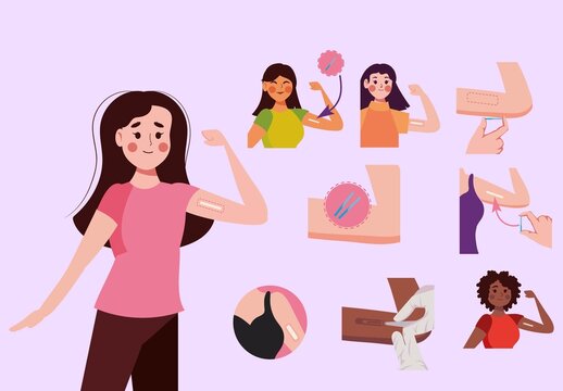 Contraceptive Implant Illustration Set