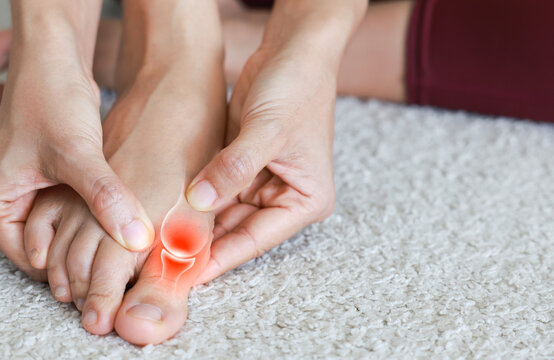 Close up of woman massaging painful big toe with anatomical joint illustration and red highlight. Hallux valgus, gout, bunion and bone inflammation concept for medical health care.