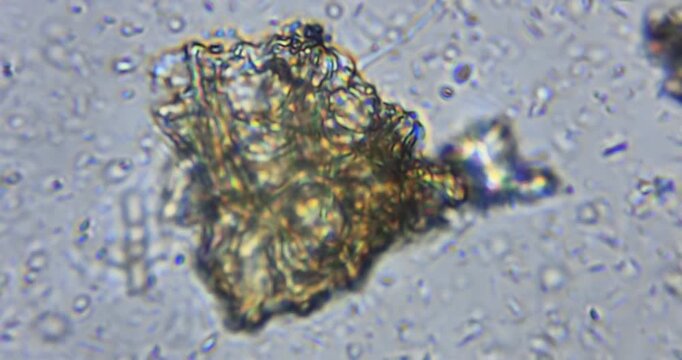 high-magnification microscopic footage revealing a natural micro ecosystem in a drop of water. Protozoa, amoeba-like organisms, rotifers