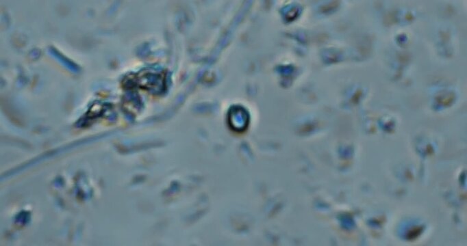 live microscopic video displaying continuous movement of microorganisms in soil extract and pond water samples