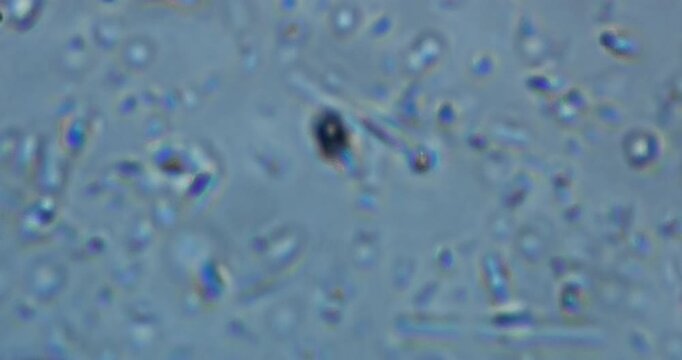 high-magnification microscopic footage showing living microorganisms in a natural aquatic environment. 