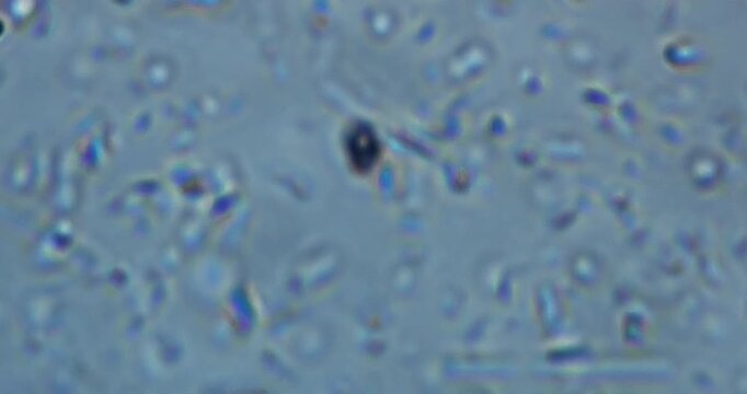high-magnification microscopic footage showing living microorganisms in a natural aquatic environment. The video captures real-time movement of protozoa