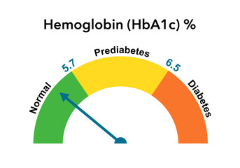 Blood sugar glucose level test for diagnostic diabetes with different diagnosis normal, prediabetes and diabetes