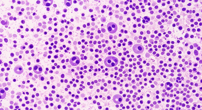 Microscopic view of bone marrow cells with segmented neutrophils and small lymphocytes