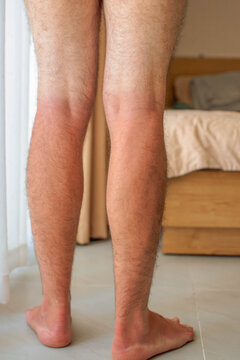 Rear view of male legs from heels to above knees with visible sunburn line