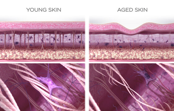 Simile of collagen fibers in young and aging wrinkled skin. 3D illustration