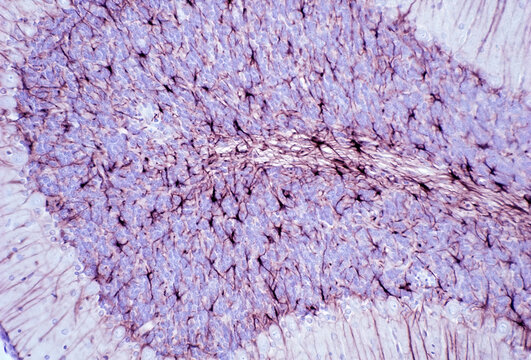 Cerebellum. GFAP