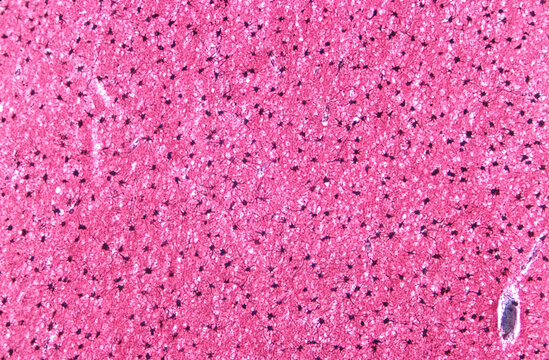 Human brain. Fibrous astrocytes. Cajal's gold sublimate technique