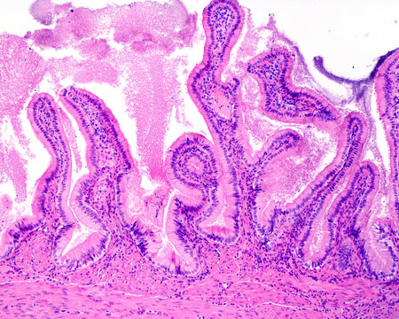 Human gallbladder mucosa