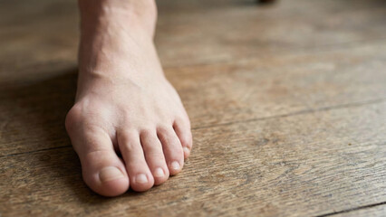 Human Foot Showing Hallux Valgus Deformity on Wooden Floor Surface