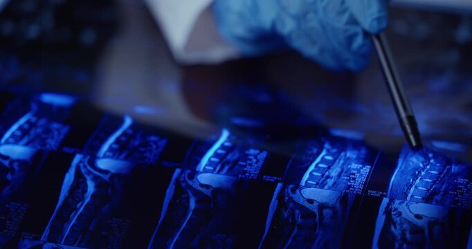 Doctor in gloves pointing and moving across sequential spine mri scan images for detailed analysis and diagnosis, closeup medical review and radiology workflow.