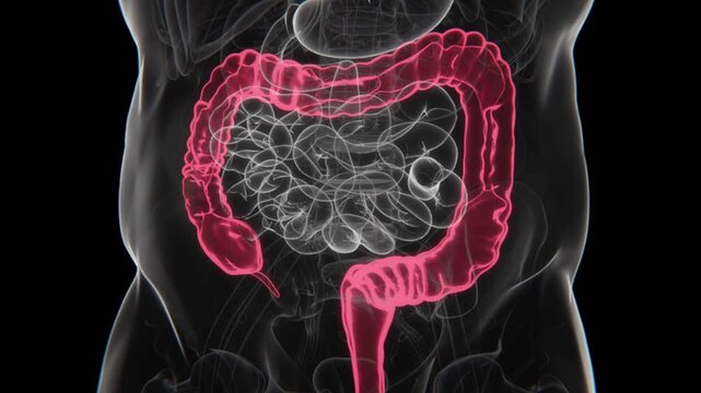 Crohn&rsquo;s Disease Indication X-ray in HD Video | Crohn&rsquo;s Disease X-ray in HD Video