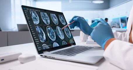 Female Neuro Radiology Technician Diagnosing Brain Injury