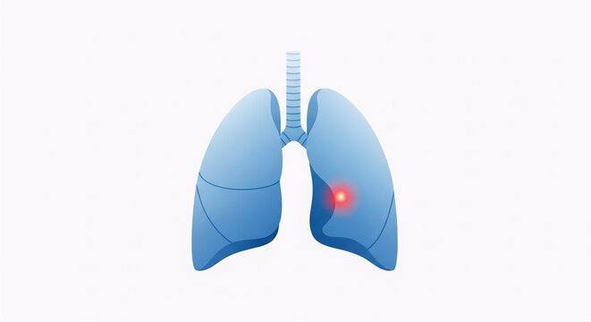 World Tuberculosis Day Concept with Human Lungs and Infection Highlight