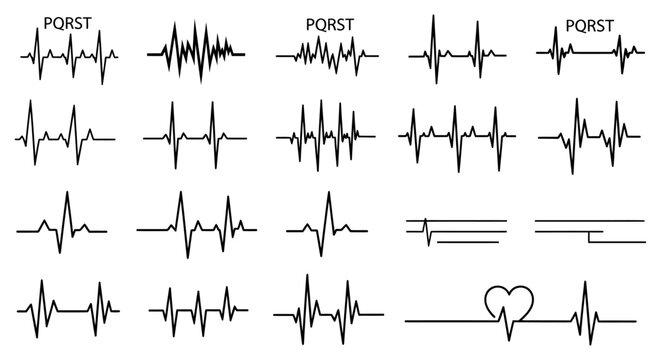 diverse electrocardiogram heartbeat line set illustrating medical health monitoring concepts and various heart rhythm patterns for health.