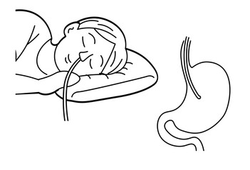 Endoscopy Examination with Stomach Anatomy Line Art Medical Illustration for Gastroenterology and Healthcare Education