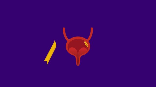 template video for Bladder Cancer Awareness Month is observed in May each year. It's a time dedicated to raising awareness about bladder cancer.