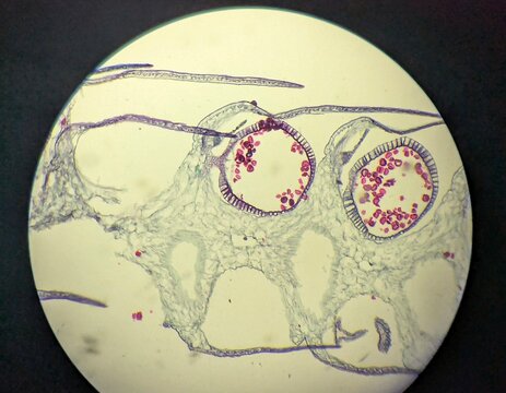 A light micrograph showing the longitudinal section (L.S.) of the club moss- Selaginella sp., strobilus or cone. This structure is a reproductive part of the plant, containing mega and micro spores.