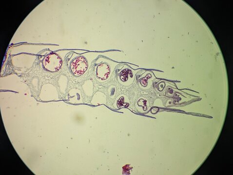 A light micrograph showing the longitudinal section (L.S.) of the club moss- Selaginella sp., strobilus or cone. This structure is a reproductive part of the plant, containing mega and micro spores.