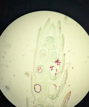 A light micrograph showing the longitudinal section (L.S.) of a Lycopodium sp., strobilus or cone. This structure is a reproductive part of the plant, containing spores, particularly, microspores.