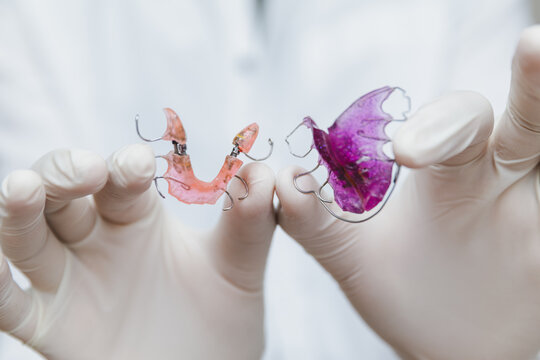 Orthodontist hands in medical gloves holding two colorful removable dental plates for upper and lower jaw, professional pediatric dentistry and orthodontic treatment concept