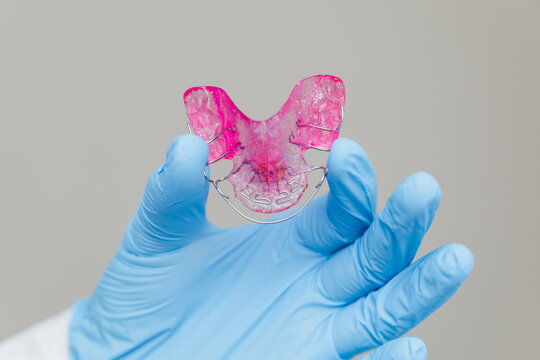 Orthodontist in blue medical glove holding pink removable dental plate for teeth alignment, professional pediatric dentistry and orthodontic correction concept