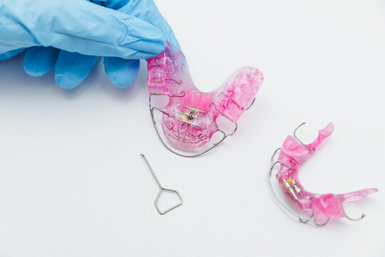 Set of pink removable orthodontic appliances for upper and lower jaw with expansion screw key, pediatric dentistry and professional bite correction concept