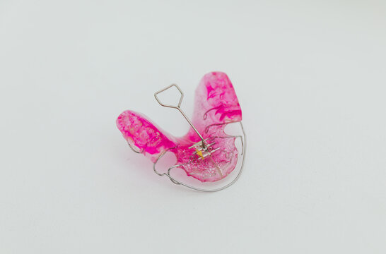 Special metal key inserted into expansion screw of pink orthodontic plate, professional dental appliance adjustment and pediatric bite correction concept