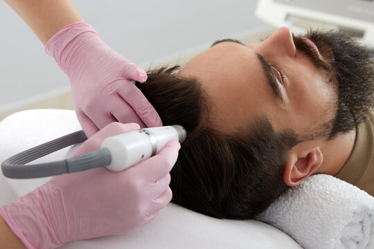 Doctor female dermatologist trichologist makes a procedure to stimulate hair growth on head to a patient man